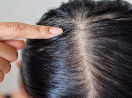 علت موی چرب چیست؟ راهکارهای درمان موی چرب