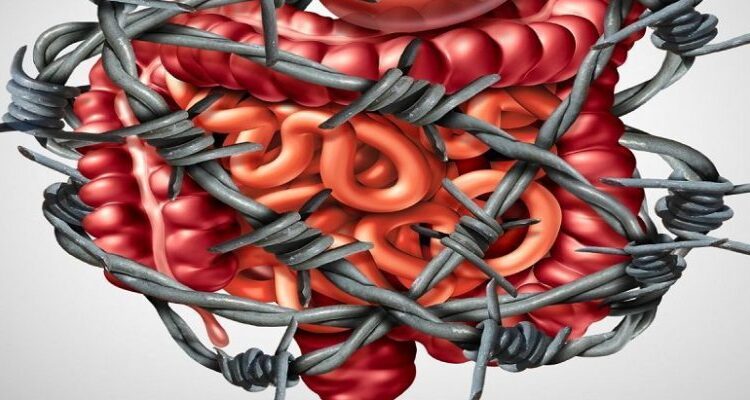 یبوست چیست ؟ علل و راه های درمان آن