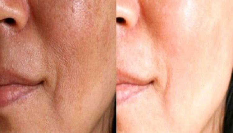 بهترین دکتر پوست